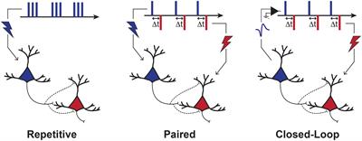 Neurostimulation for Stroke Rehabilitation